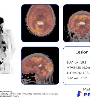 PAIRE : quand l’IA facilite le diagnostic médical