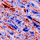 See the structure of collagen in 3D