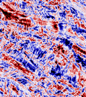 See the structure of collagen in 3D