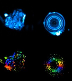 Probing biominerals: two (or three) photons are better than one