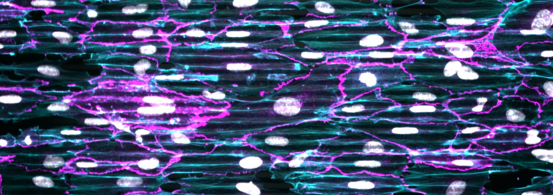 Le mouvement collectif des cellules vu sous l'angle de la mécanique des fluides