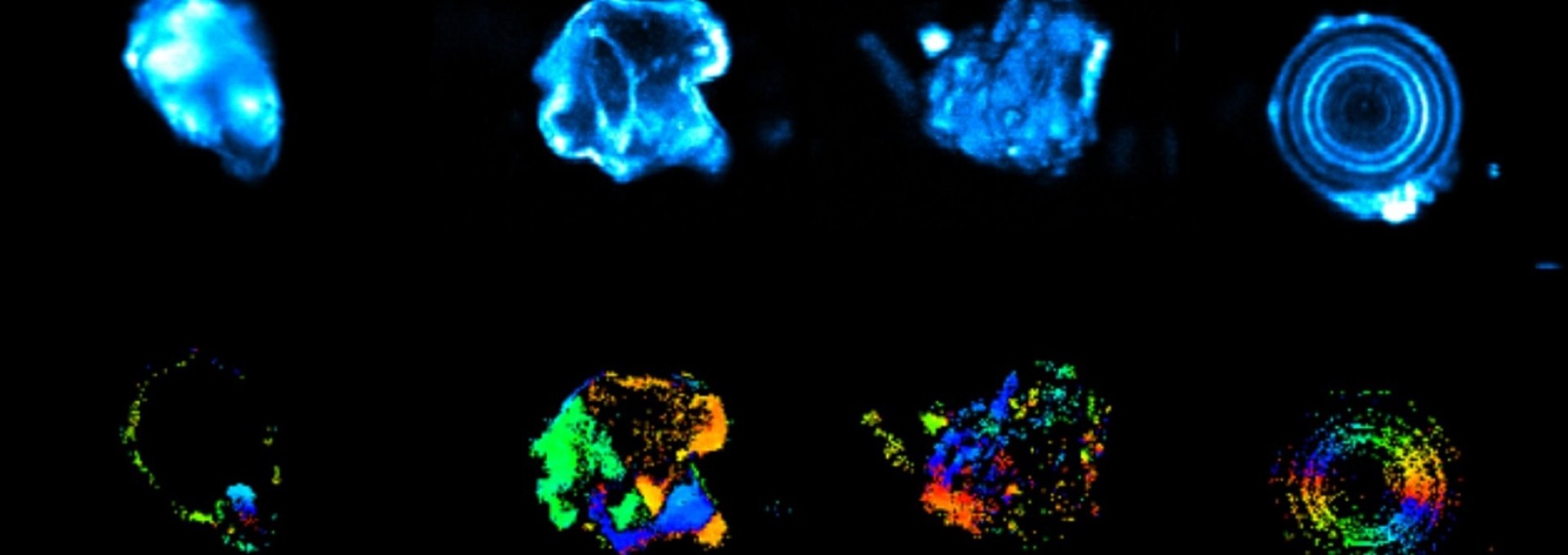 Probing biominerals: two (or three) photons are better than one